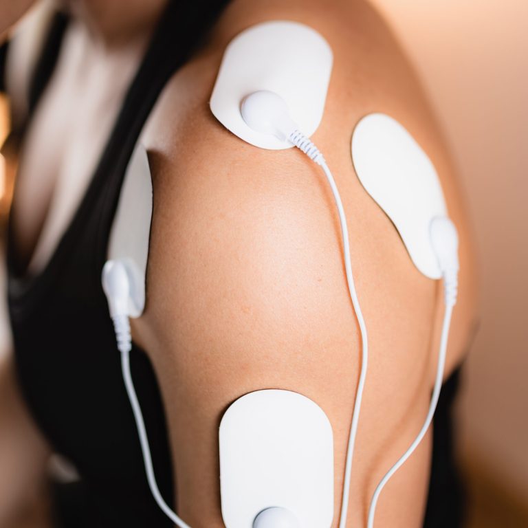 Shoulder Physical Therapy with TENS Electrode Pads, Transcutaneous Electrical Nerve Stimulation.